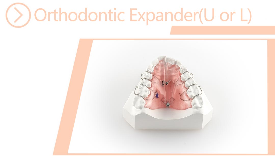 Orthodontic Expander(U or L)