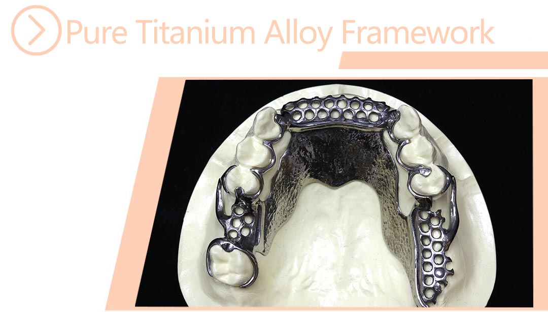 Pure Titanium Alloy Framework
