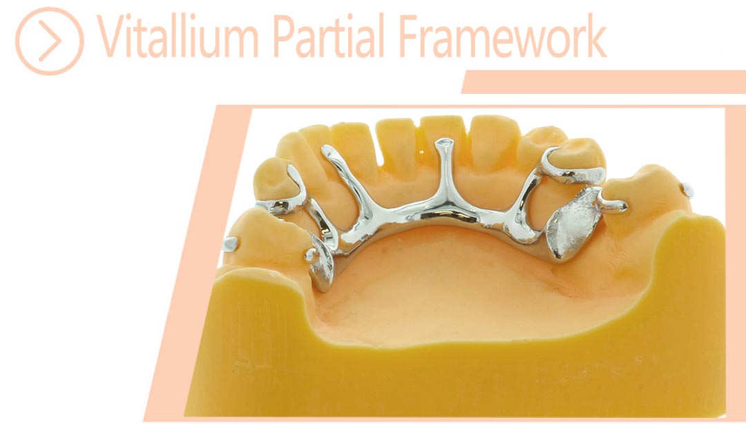Vitallium Partial Framework