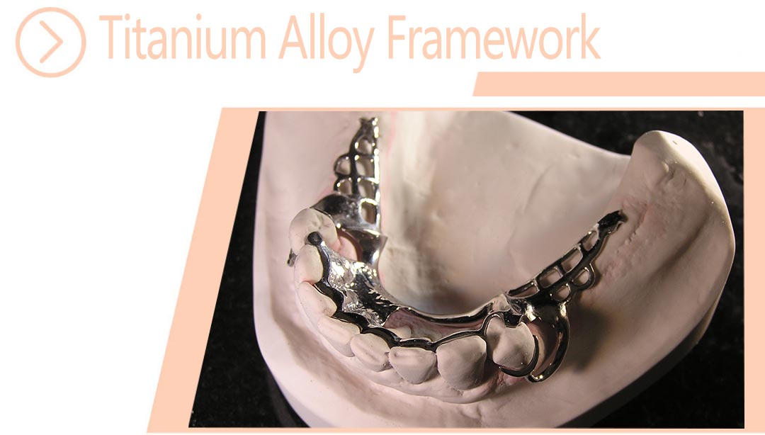 Titanium Alloy Framework
