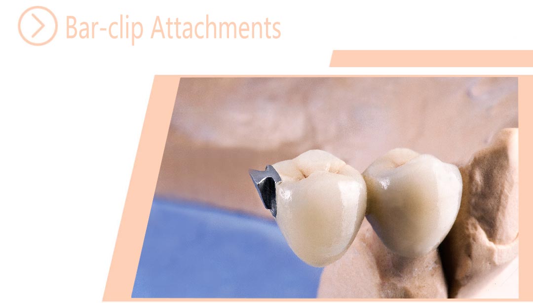 Bar-clip Attachments