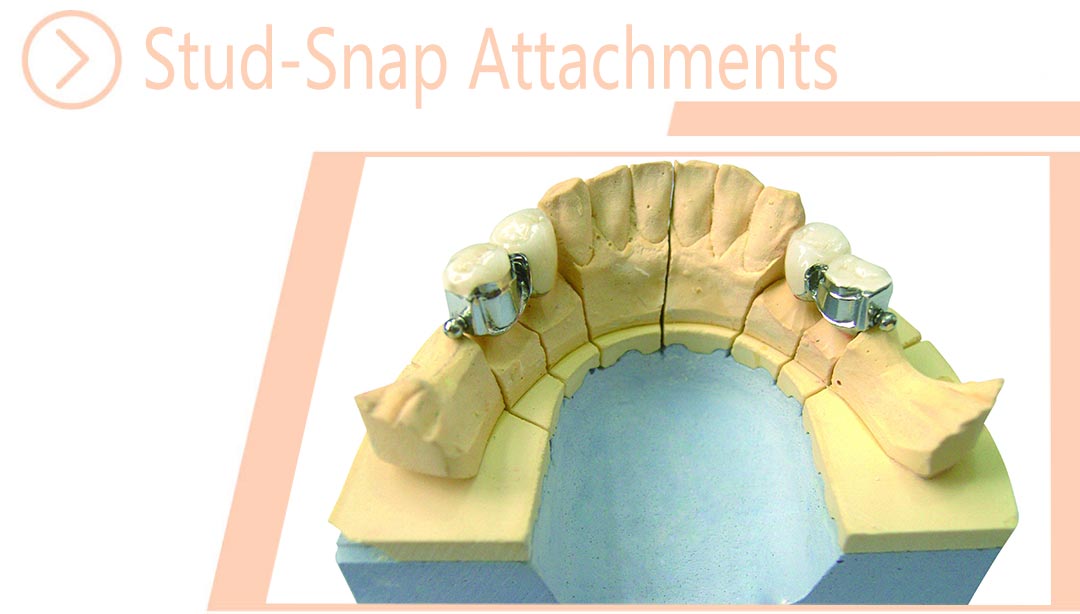 Stud-Snap Attachments