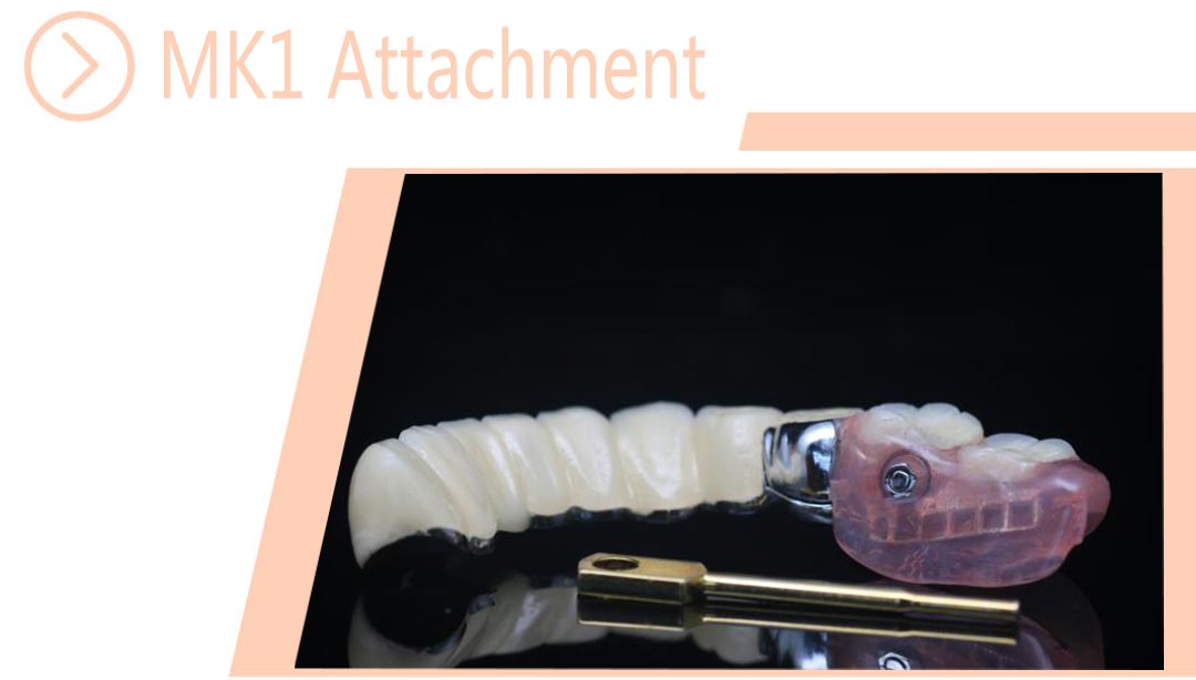 MK1 Attachment