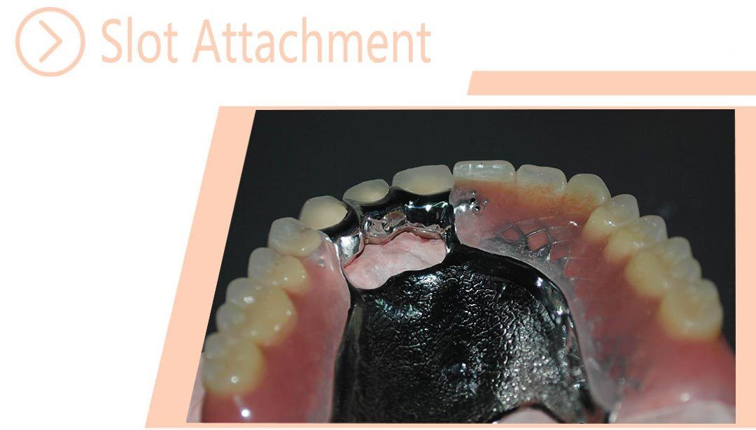 Slot Attachment