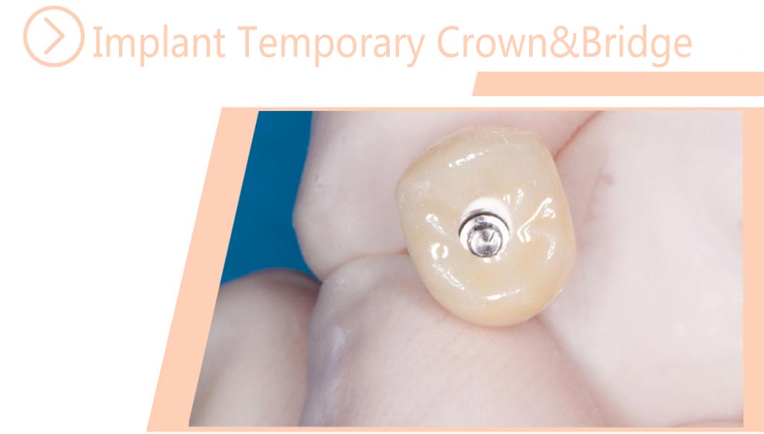 Implant Temporary Crown&Bridge