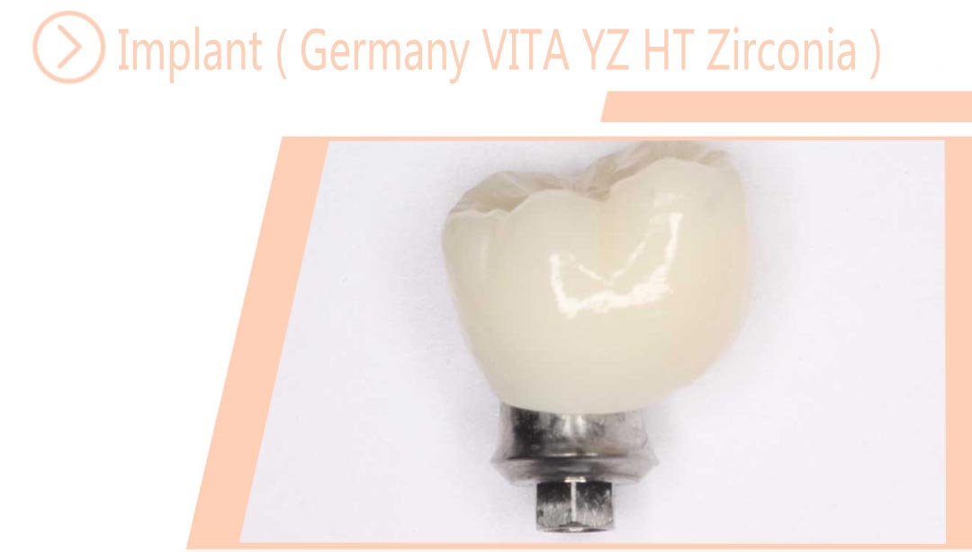 Implant ( Germany VITA YZ HT Zirconia )
