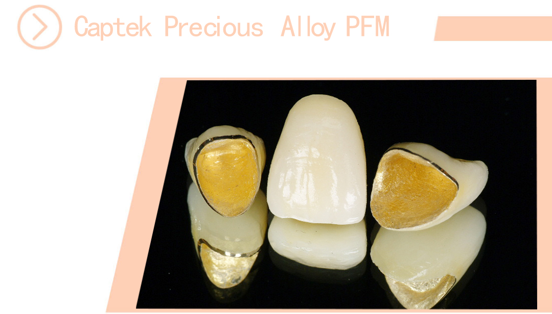 Captek Precious Alloy PFM