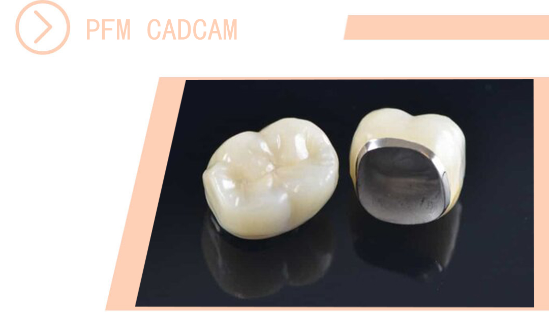 PFM CAD/CAM