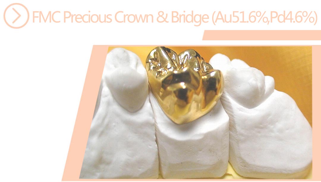 FMC Precious Crown&Bridge(Au51.6%,Pd4.6%)