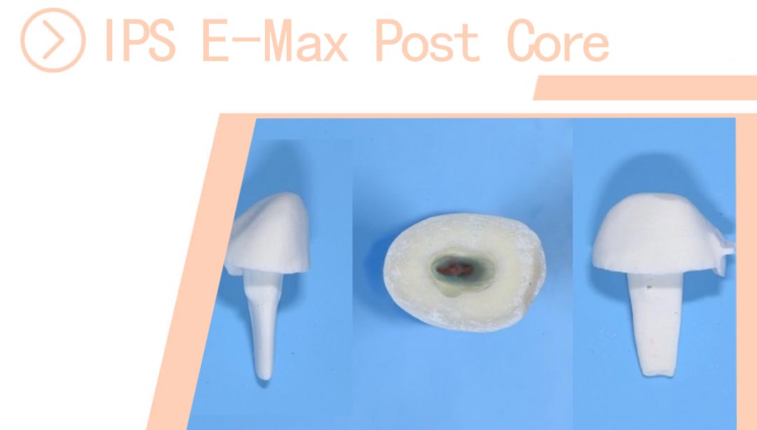 IPS E-Max Post Core