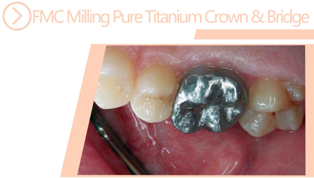 FMC Milling Pure Titanium Crown&Bridge
