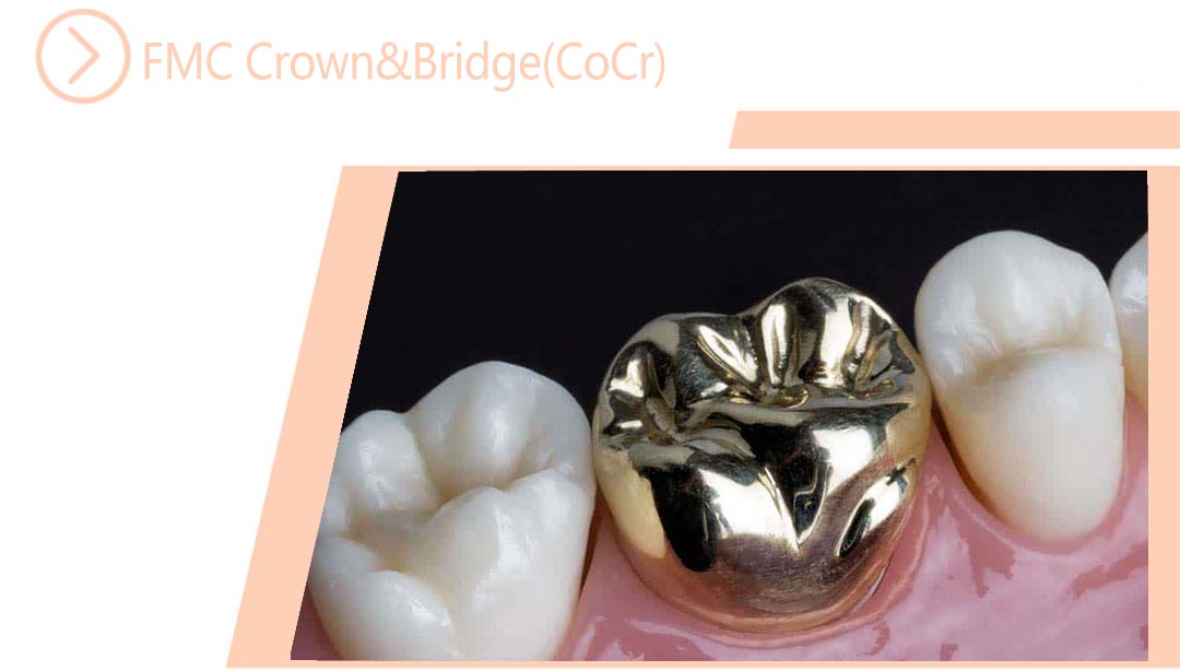 FMC Crown&Bridge(CoCr)