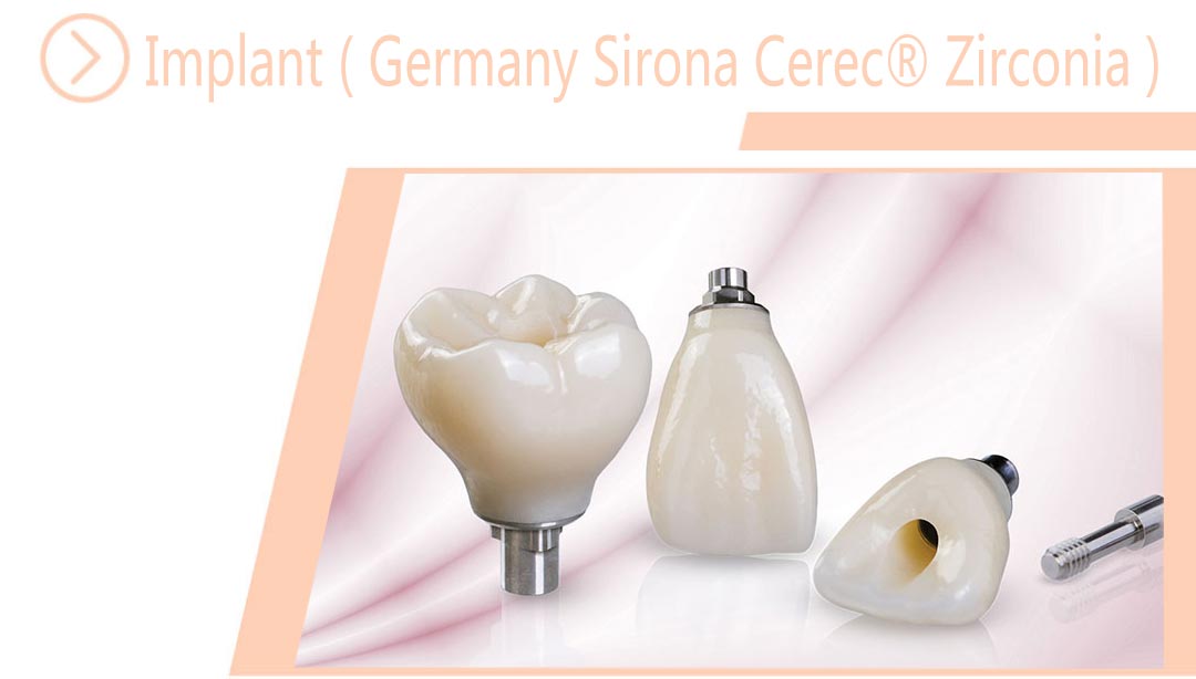 Implant ( Germany Sirona Cerec® Zirconia )