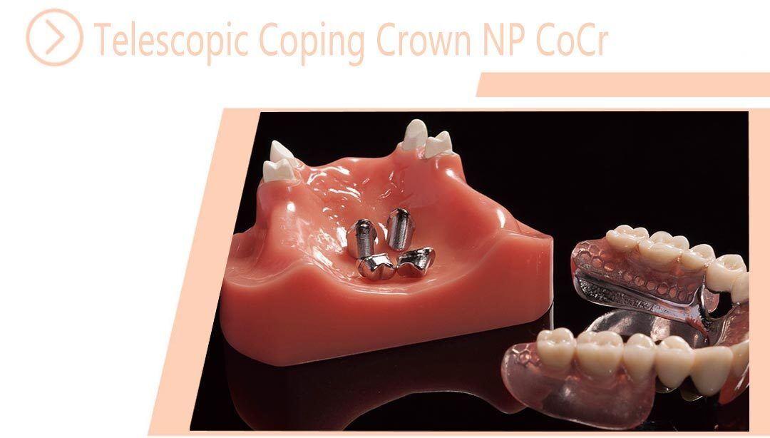 Telescopic Coping Crown NP CoCr
