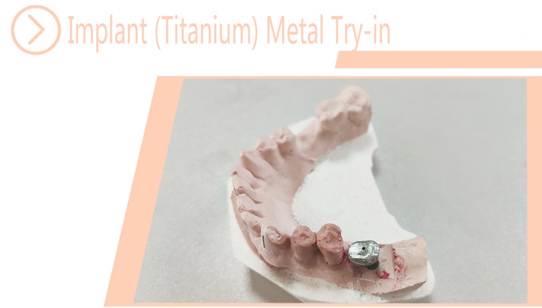Implant (Titanium) Metal Try-in
