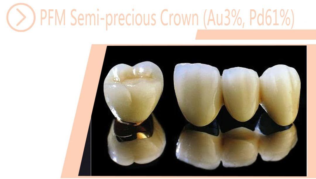 PFM Semi-precious Crown (Au3%, Pd61%)