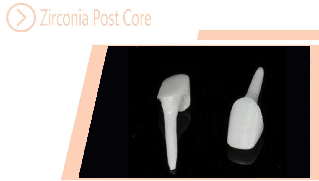 Zirconia Post Core